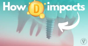 How Vitamin D impacts the implants